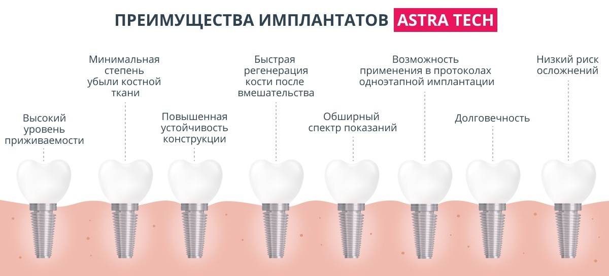 Профессиональная чистка зубов - оборудование и инструменты