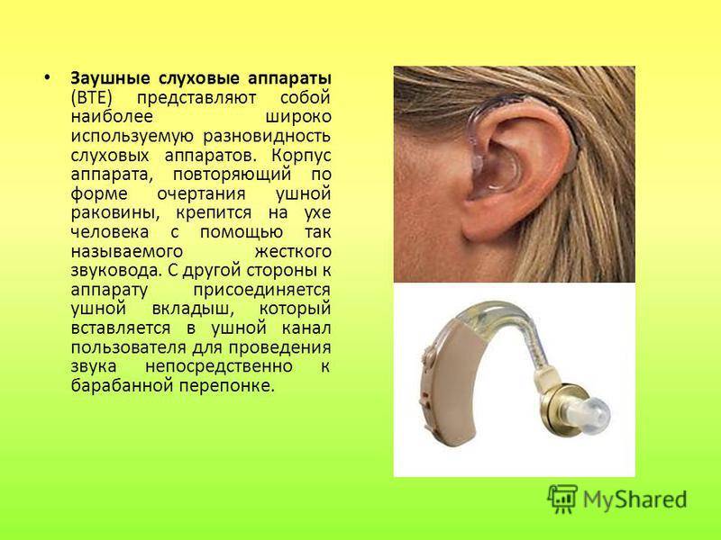 Как выбрать слуховой аппарат: виды, особенности, плюсы и минусы