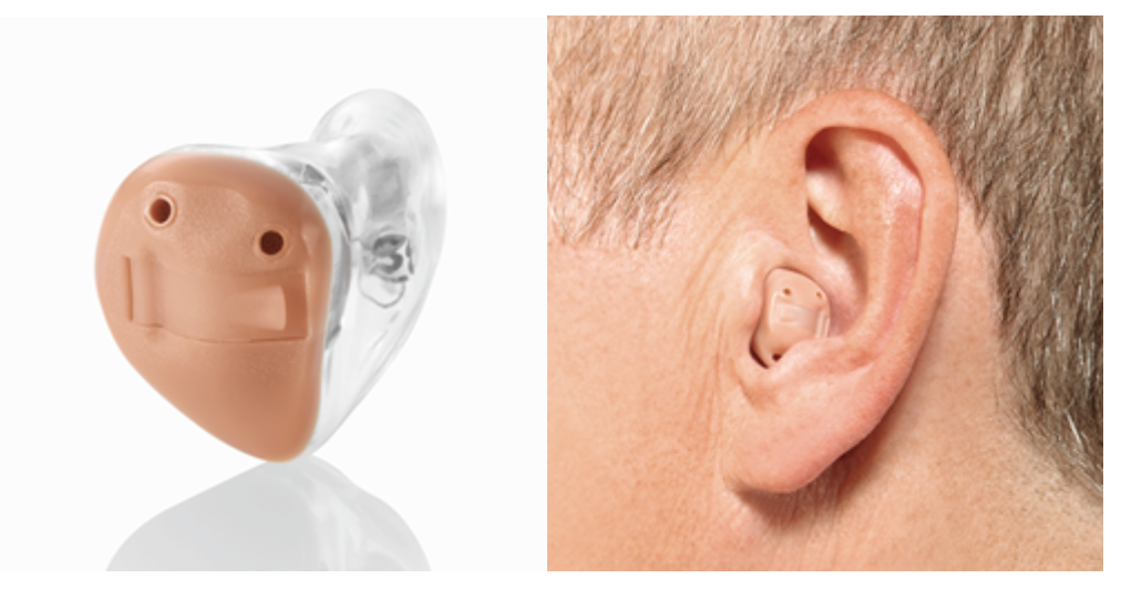 Слуховые аппараты для пожилых людей. особенности покупки слухового аппарата пожилому человеку