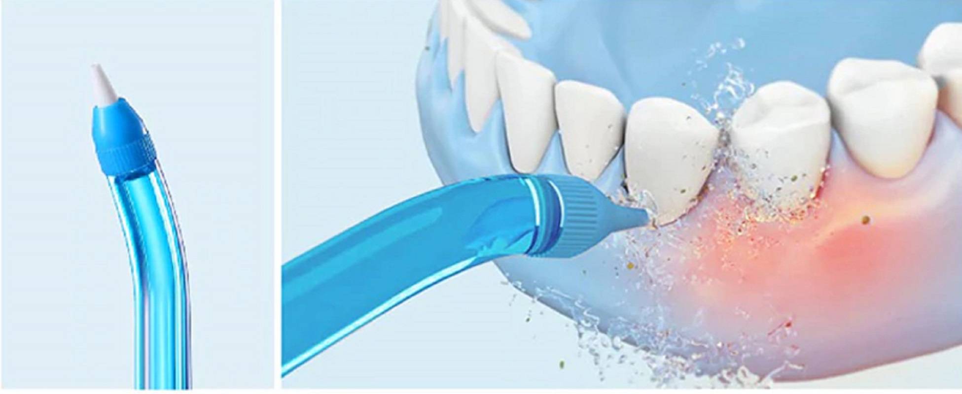 Как правильно чистить зубы ирригатором?